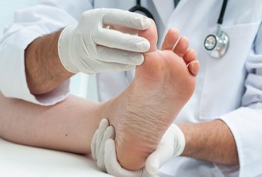 Δυναμική Ανάλυση Βάδισης – Ισορροπίας (πελματογράφημα) Δυσμορφίες άκρου ποδός – δακτύλων